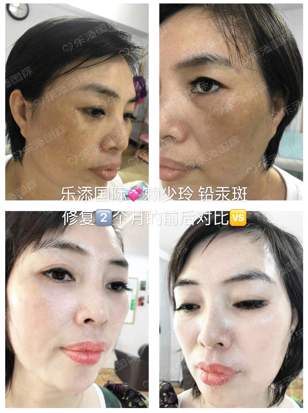 案例4 案例4